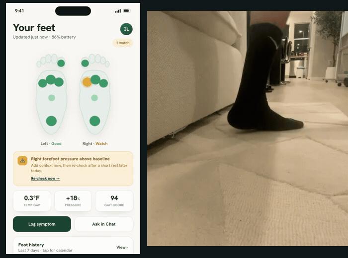 Real walking footage of a Smart Sock beside the app interface preview